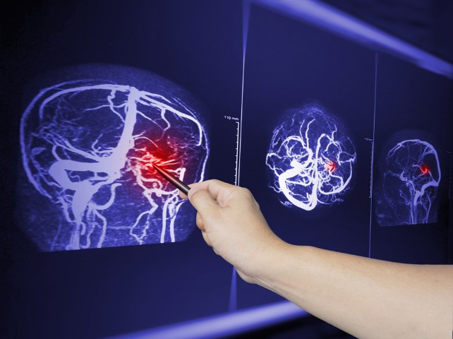 Injuries add up: How brain injuries accumulate